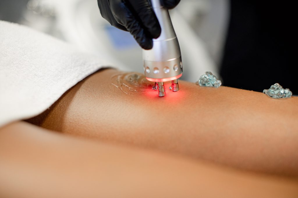 radio frequency | Aesthetica MD Med Spa