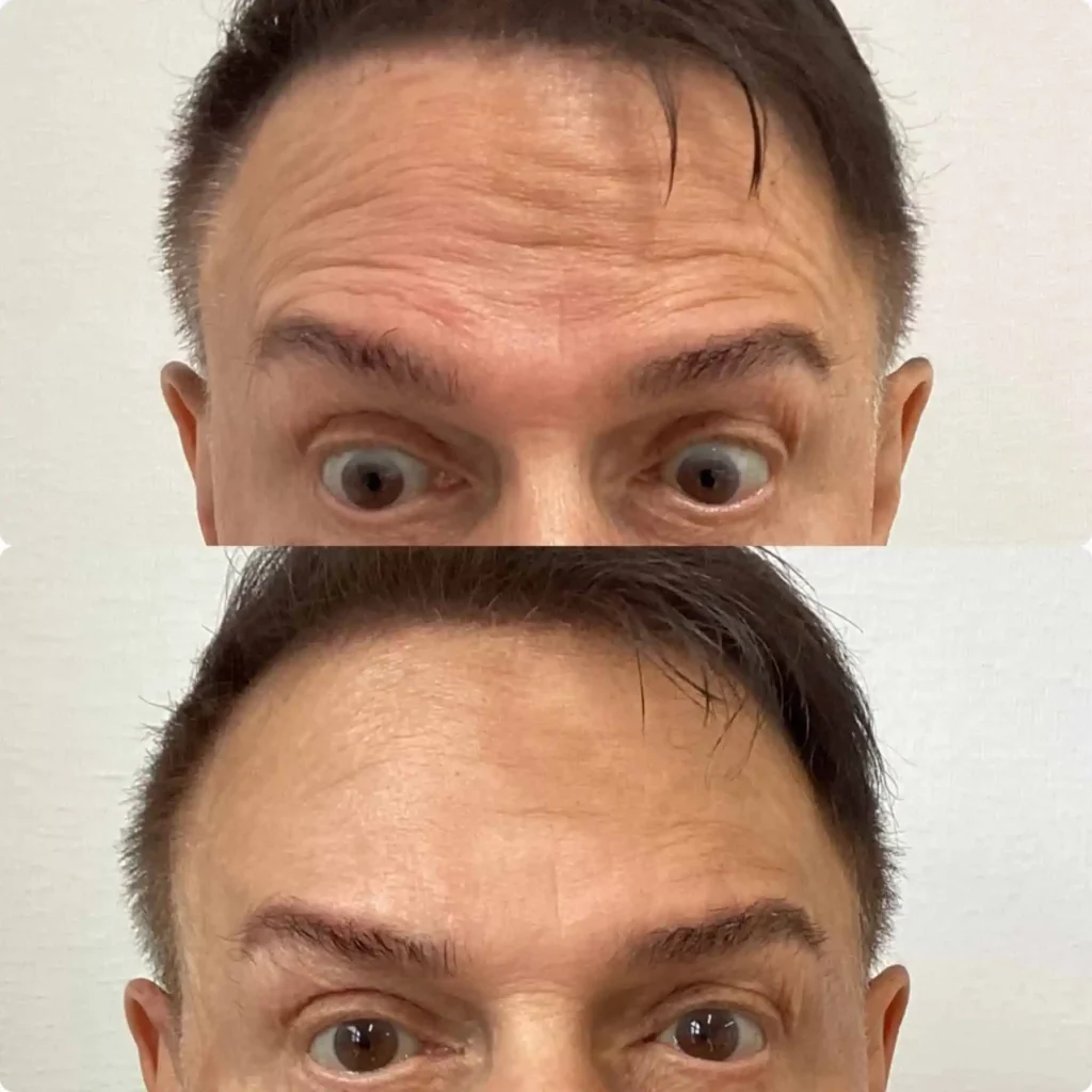 beforeafter 41