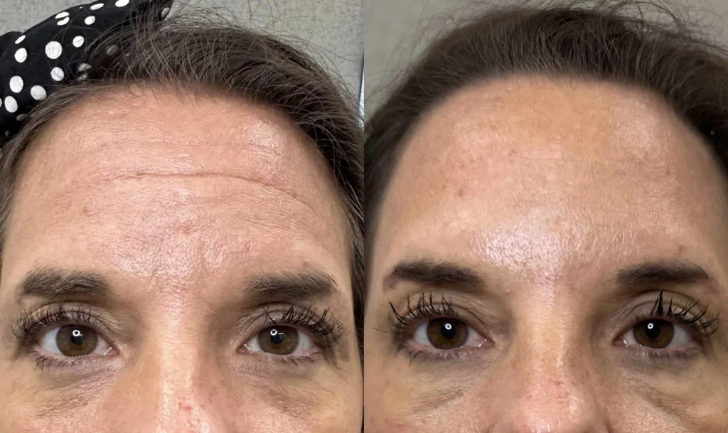 before&after iamge