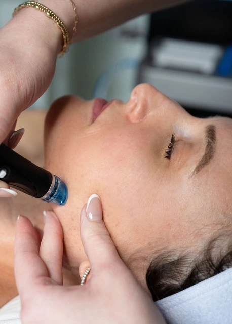 HydraFacial 6