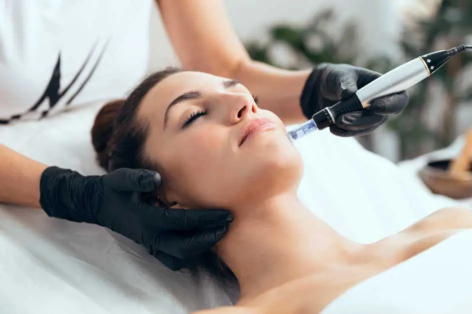 Microneedling with PRP at Aesthetica MD Med Spa in Cypress, TX