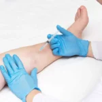 Vein Treatment by Cypress Wellness & Aesthetics LLC in Cypress, TX
