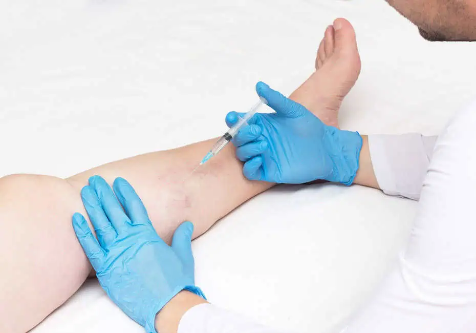 Vein Treatment by Cypress Wellness & Aesthetics LLC in Cypress, TX
