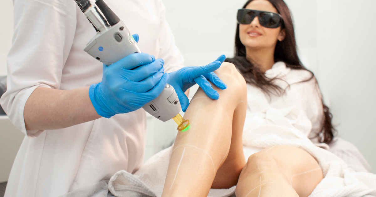 Woman receiving laser hair removal treatment on her legs by a professional wearing blue gloves in Cypress, TX