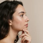 Woman Struggling With Acne Scars in Cypress, TX