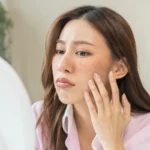 Woman concern about dark spots in Cypress, TX