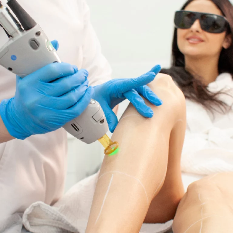 Woman receiving laser hair removal treatment on her legs by a professional wearing blue gloves in Cypress, TX