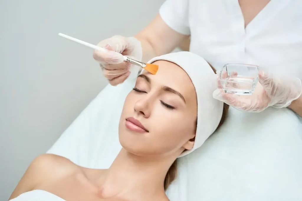 Improve Sun Damage with chemical peel